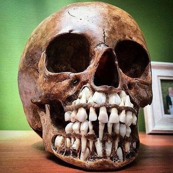 2. Süt dişleri, kafatasının içinde bu şekilde görünür.