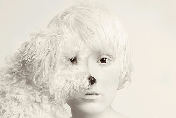 Вы опекаемый