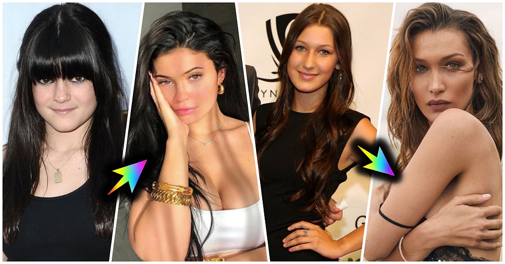 Geçirdikleri Estetik Operasyonlardan Sonra Adeta Bambaşka Birine Dönüşen Dünyaca Ünlü Kadınlar