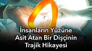 Acıları Dindirsin Diye Keşfettiği Anestezi Yüzünden Hayatı Olabilecek En Acı Şekilde Sonlanan Bilim İnsanı Horace Wells