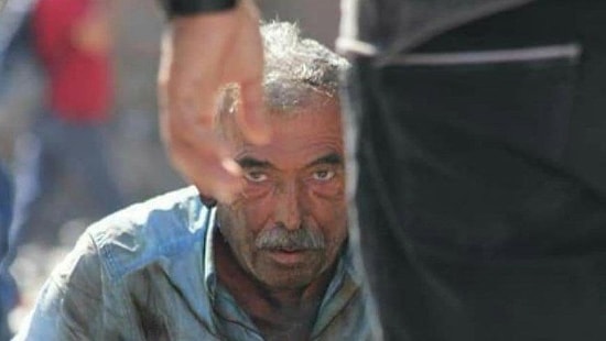 Ankara'da Kendisini Yakan Vatandaş: 'Adalet Beni Bitirdi'