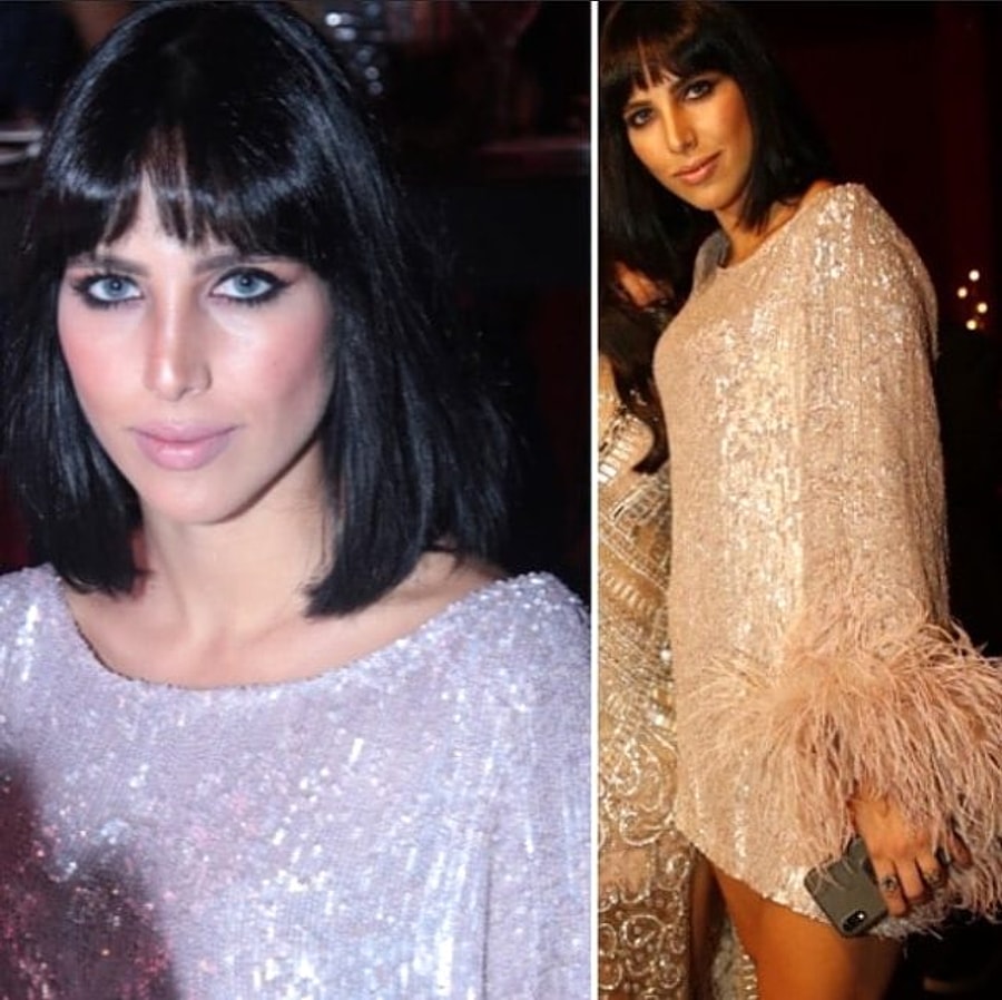 Artik Bu Tartismaya Son Noktayi Koyuyoruz Degisimiyle Sasirtan Zehra Cilingiroglu Estetikli Mi Degil Mi Artik Bu Tartismaya Son Noktayi Koyuyoruz Degisimiyle Sasirtan Zehra Cilingiroglu Estetikli Mi Degil Mi