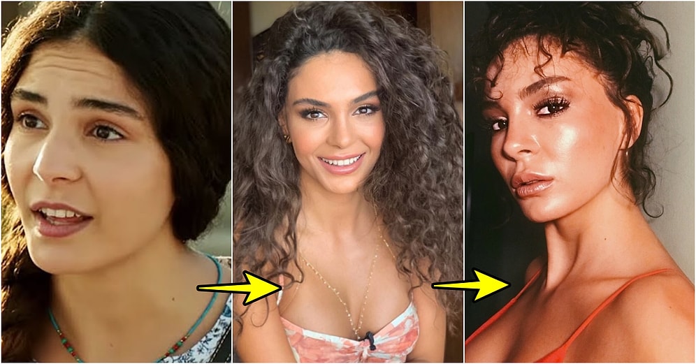 Estetikli mi Değil mi? Hercai Dizisinin Reyyan'ı Ebru Şahin'in Eski Fotoğrafı Sosyal Medyada Olay Oldu!