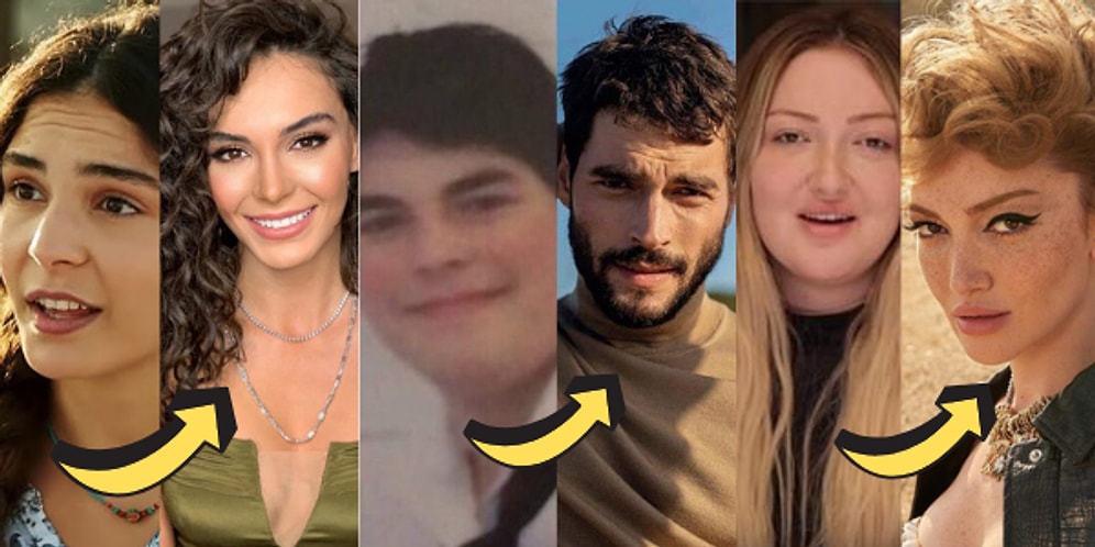 Son Zamanlarda Geçirdikleri Değişimlerle Sosyal Medyanın Diline Bomba Gibi Düşen 13 Ünlü