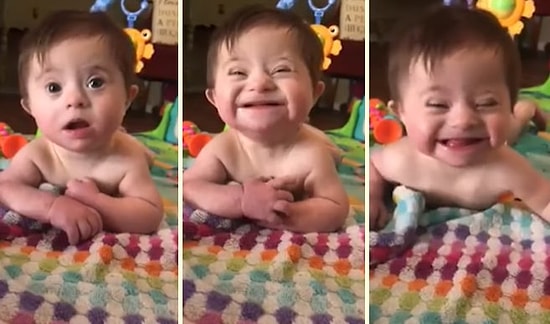 Evlat Edinilen Down Sendromlu Ufaklığın, Annesinin Sözleri Karşısında Gülmeye Başladığı Muhteşem Anlar!