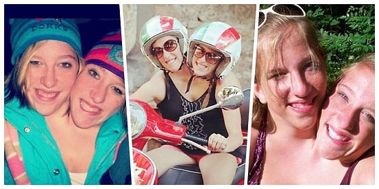 Tek Bir Bedeni Paylaşmanın Avantajı, Dezavantajıyla Ünlü Yapışık İkizlerin Gözler Önüne Serilen Yaşamı