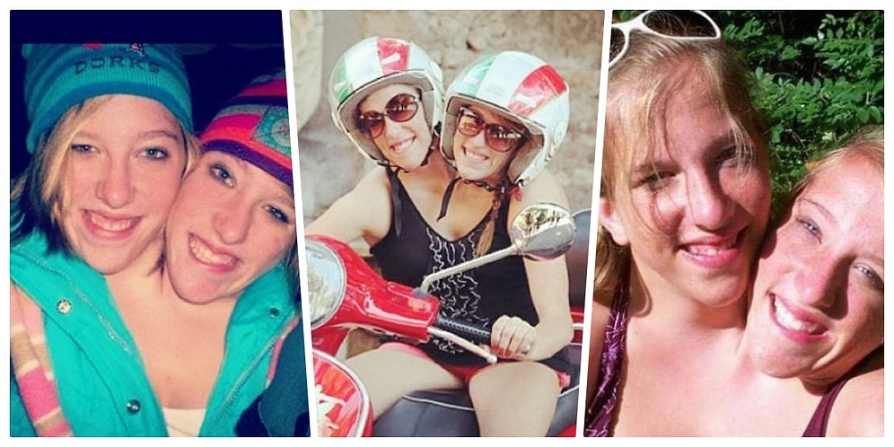 Tek Bir Bedeni Paylaşmanın Avantajı, Dezavantajıyla Ünlü Yapışık İkizlerin Gözler Önüne Serilen Yaşamı