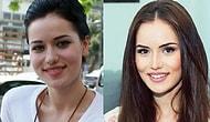 5 турецких актрис до и после пластики