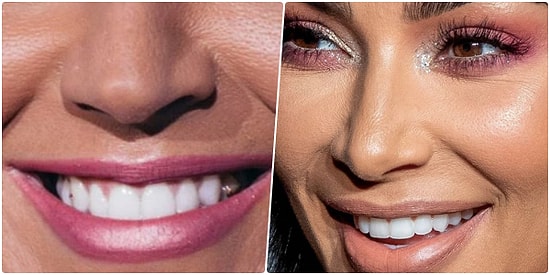 Yakından Fotoğrafını Verdiğimiz Ünlüyü Tanıyabilecek misin?