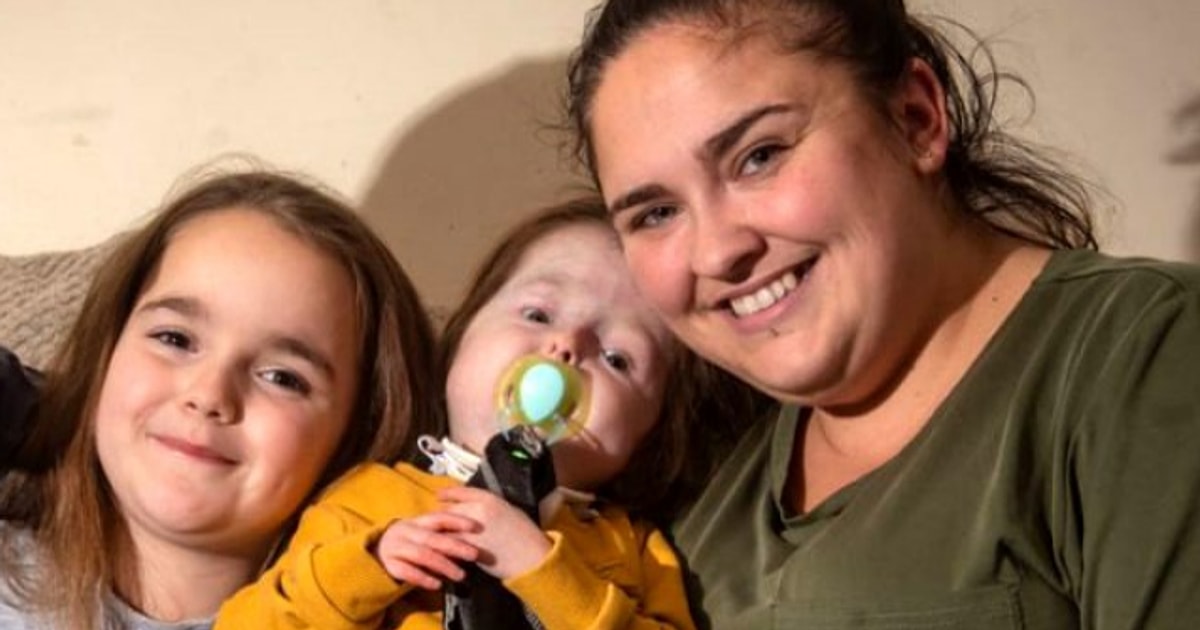 Dünya Üzerinde Sadece 2 Yaşındaki Isla KilpatrickScreaton'ın Sahip