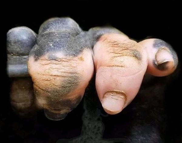 3. Vitiligo hastası bir gorilin elleri: