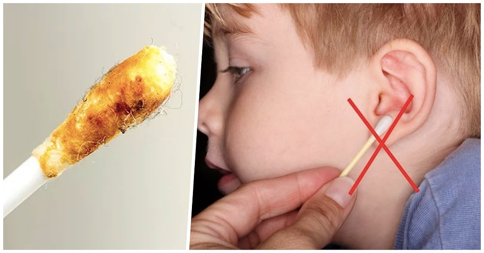 Kulak Kiriyle İlgili Duyunca Elinizi Kulağınıza Götürtecek 17 Enteresan Bilgi