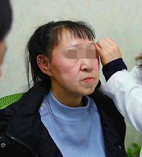 Xiao Feng, ameliyatından bir ay sonra yeni görünümü ile insanların karşısına çıktı. O güne kadar aynaya bakması yasak olan Feng, kendisini gördüğü an ağlamaya başladı.