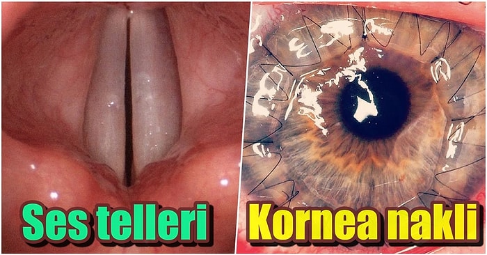 Dikkat Hafif İrkilebilirsiniz! İnsan Vücuduyla Alakalı Belki de İlk Defa Göreceğiniz 20 İlginç Görüntü