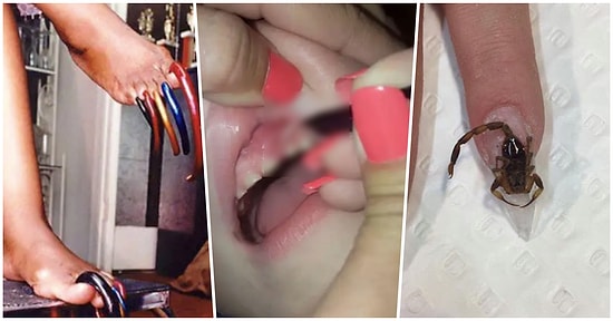 Midesi Minnoş Olanlar Bakmasın! El ve Ayak Tırnaklarıyla İlgili Ömür Kısaltan Birbirinden İğrenç 17 Fotoğraf