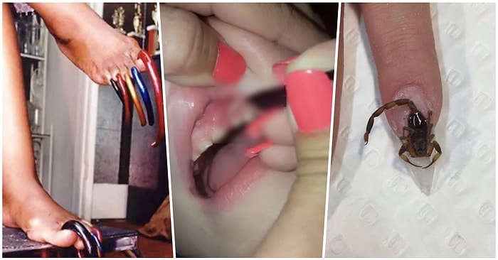 Midesi Minnoş Olanlar Bakmasın! El ve Ayak Tırnaklarıyla İlgili Ömür Kısaltan Birbirinden İğrenç 17 Fotoğraf