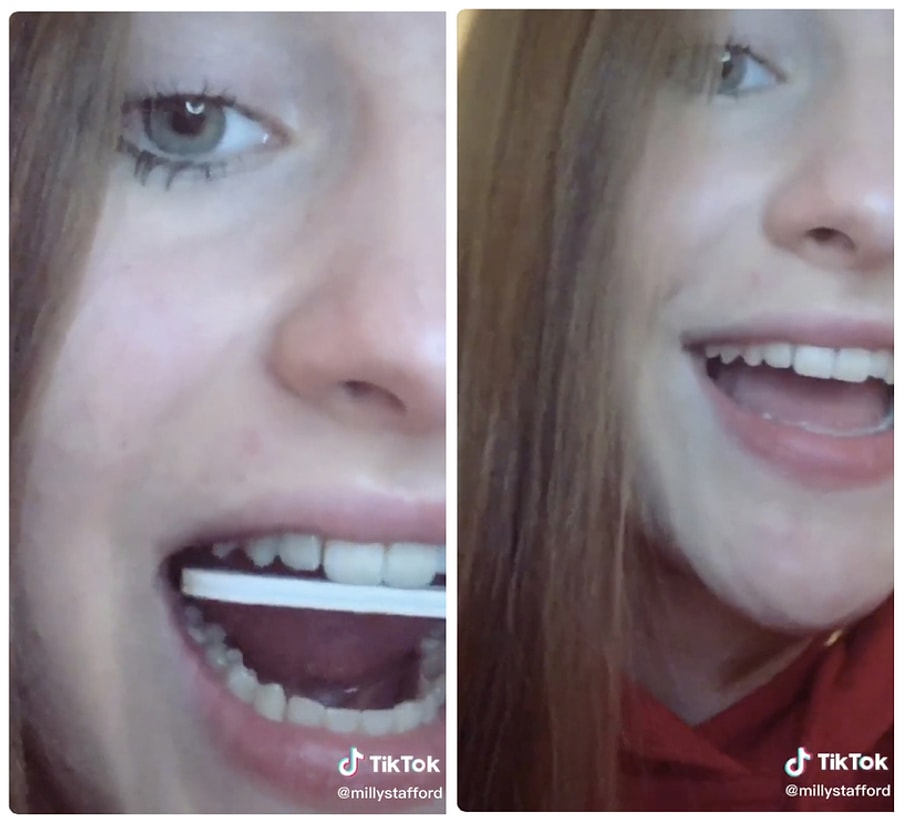 siz sakin evde denemeyin tiktok ile populer hale gelen en tuhaf 12 guzellik trendi