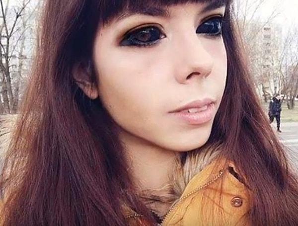 Aleksandra Sadowska'nın avukatları:"Dövme sanatçısının, bu denli hassas bir işi nasıl yapacağını bilmediği apaçık ortada." diyorlar.