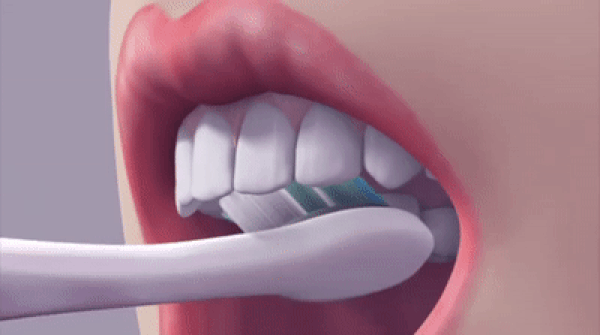 1. Dişlerinizi düzenli olarak nazikçe fırçalayın.