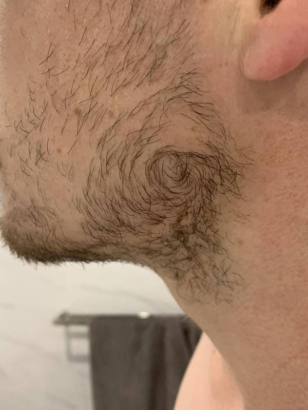 12. «Щетина на моем лице растет вихрем».