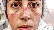 Hastanelerde Canla Başla Mücadele Eden Sağlık Çalışanlarımızın Yakınlarının Bu Serzenişlerine Mutlaka Kulak Vermelisiniz