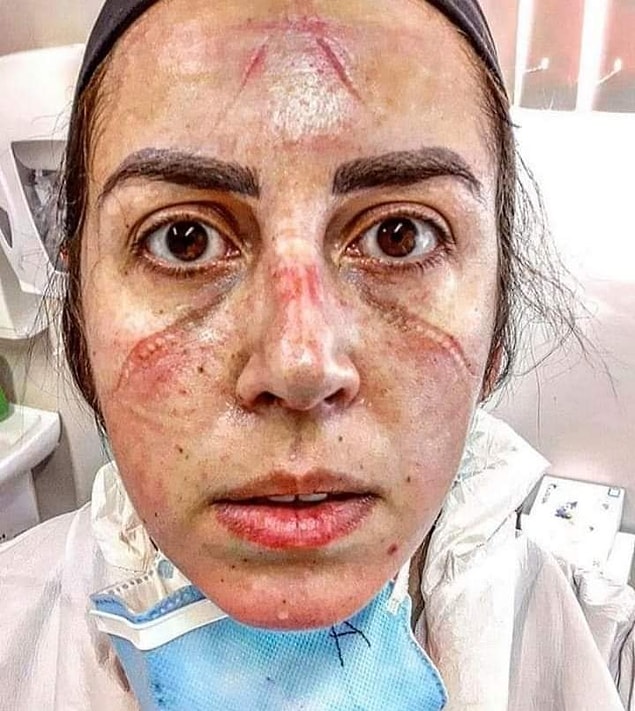 Koronavirüsle mücadelenin en başından beri en önde savaşıp bu salgından en çok etkilenenler sağlık çalışanlarımız oldu.