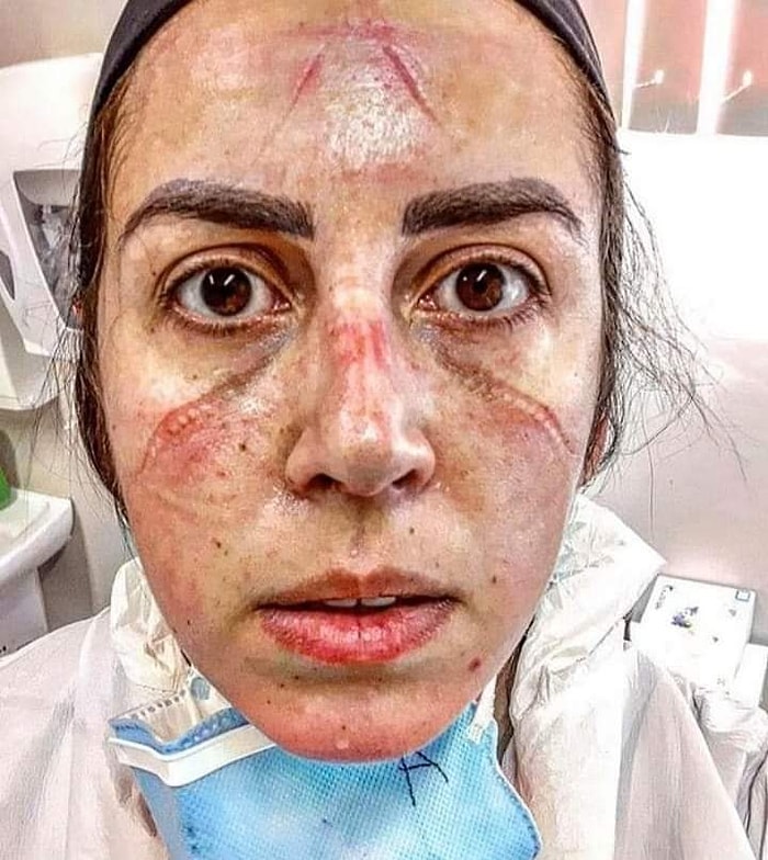 Hastanelerde Canla Başla Mücadele Eden Sağlık Çalışanlarımızın Yakınlarının Bu Serzenişlerine Mutlaka Kulak Vermelisiniz