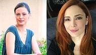 Как выглядят популярные турецкие актрисы до и после пластики?