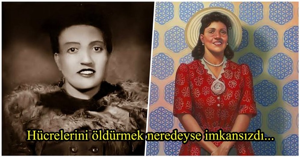 Hayatını Kaybettikten Sonra Vücudundaki Tümör Sayesinde Milyonların Kurtarılmasına Vesile Olan Kadın: Henrietta Lacks