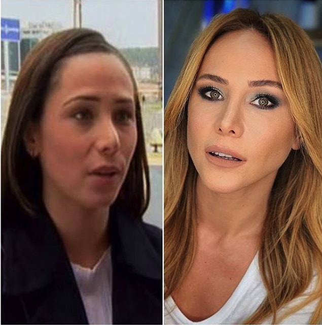 2. Burçin Terzioğlu'nun eski haliyle yeni hali arasındaki en bariz fark burun estetiği olabilir.