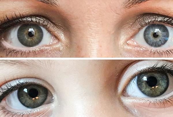14. "Kızımın da benim de sol gözümüz mavi, sağ gözümüz yeşil renkte. Kızımın mavi gözünün alt kısmında bir parça da yeşil renk var."