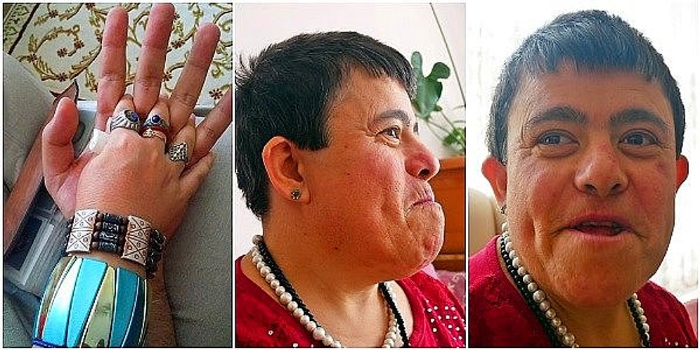Zihinsel Engelli Halası Mesude'nin Hayata Nasıl Tutunduğunu Anlatan Gençten Gözleri Dolduran Bir Hikaye
