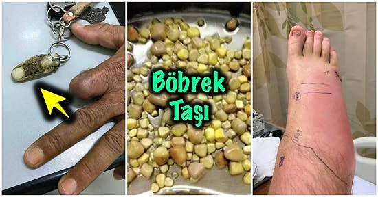 Bakmayı Başarsanız da Midenizi Kaldırıp Kalıcı Travma Yaşatacak İnternet Dehlizlerinden 19 Lanetli Görsel