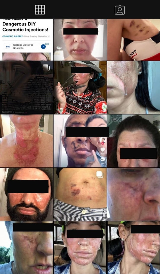 Ardından bu süreci paylaşıyor ve birçok insan aynı şikayetlerle Zoe'ya ulaşmaya başlıyor.