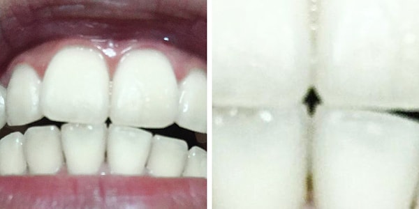 7. "Dişlerimin arasındaki boşluk ok ucuna benziyor."