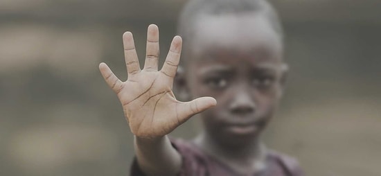 Ne Kadar Ayrıcalıklısın?