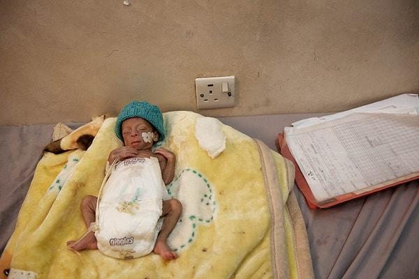 9. Bir başka hastanede dünyaya gelen prematüre bir bebek. Hayata tutunması çok zor çünkü annesi yetersiz beslendiği için ona verecek sütü bile yok.