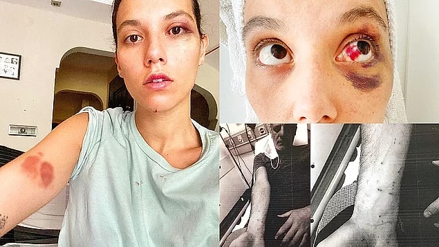 2. Sevgilisi Deniz Bulutsuz'a şiddet uyguladığı iddia edilen Ozan Güven'i destekleyen Halit Ergenç, tepkilerin odak noktası haline geldi!