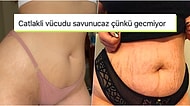 Dayatılmaya Çalışan Güzellik Standartlarını Yıkarak Vücut Çatlaklarıyla Barışan Kadınların Söylecek Bir Çift Lafı Var