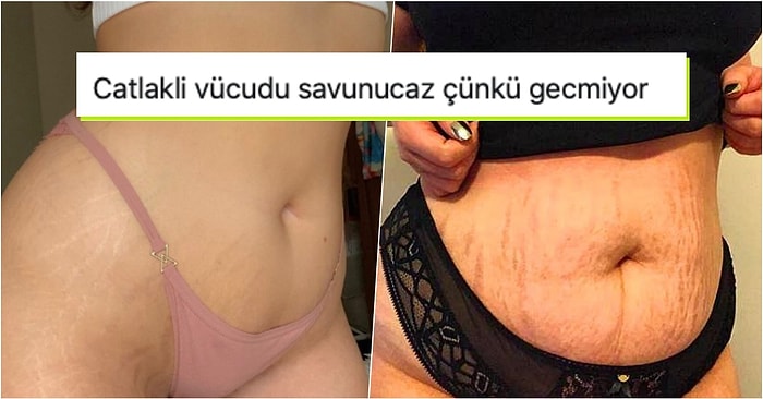 Dayatılmaya Çalışan Güzellik Standartlarını Yıkarak Vücut Çatlaklarıyla Barışan Kadınların Söylecek Bir Çift Lafı Var
