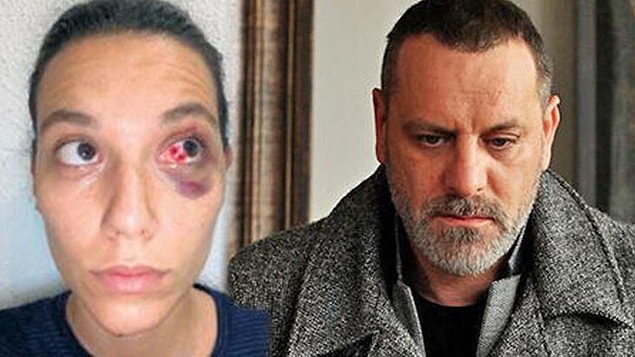 Özellikle Deniz Bulutsuz, gerçekten korkunç halde!