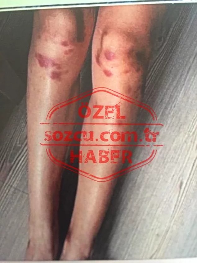 2. Ozan Güven'den şiddet gördüğü iddia edilen Deniz Bulutsuz'un yeni görüntüleri ortaya çıktı!