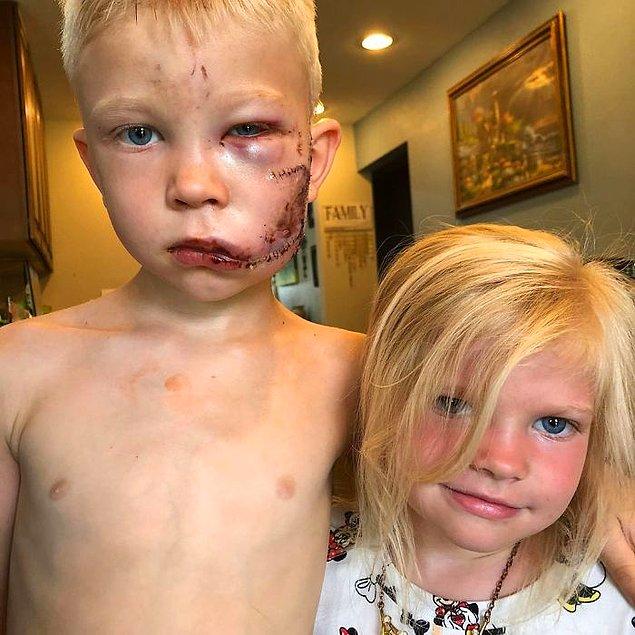 Bridger, 4 yaşındaki kız kardeşini kendilerine doğru koşan sinirli bir köpekten kurtardı.