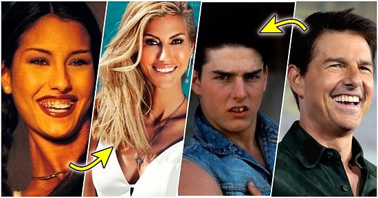 Diş Teli Tedavisinin İnsanı Ne Kadar Değiştirdiğinin Ünlü İsimler Üzerinden Kanıtı