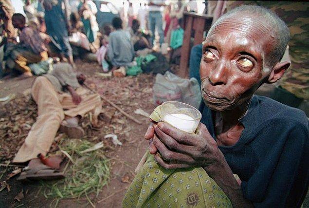 6. Ruanda'daki derme çatma hastanede açlıktan ölen insanlar, 1994.