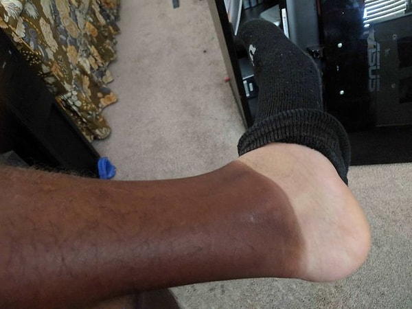 17. Разница между загорелым и незагорелым - от ноги до ступни