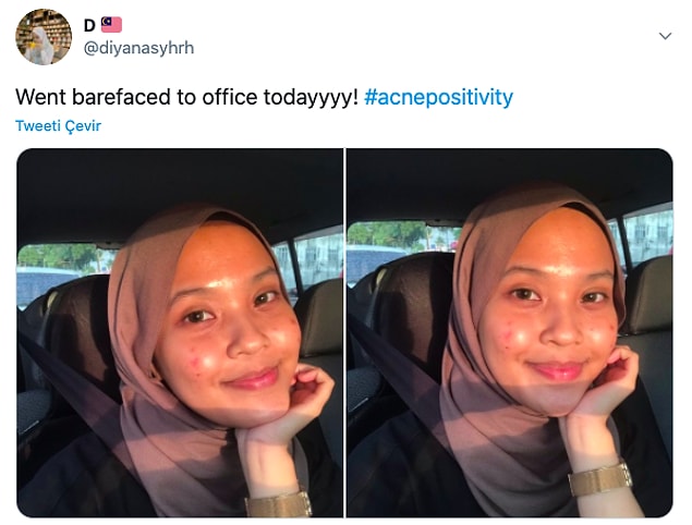 5. "Acnepositivity"