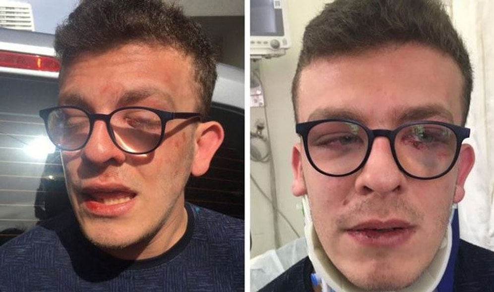 Otizmli Genci Öldüresiye Döven Saldırgana 6 Ay Hapis