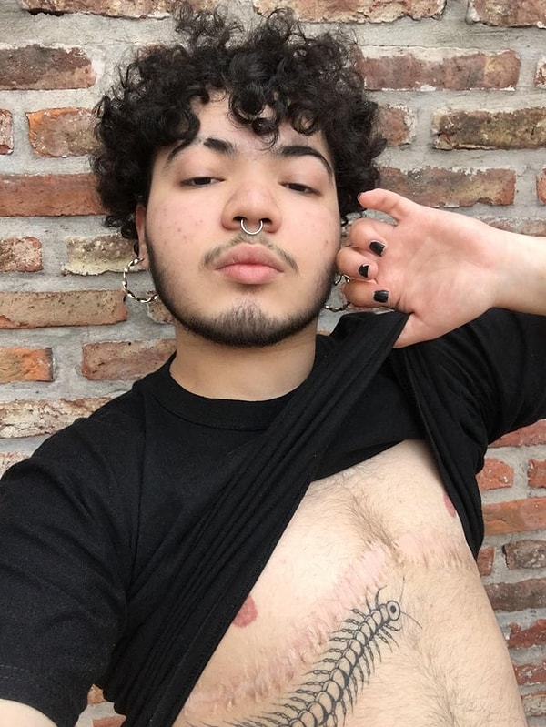 9. «Завтра будет 2 года после операции».