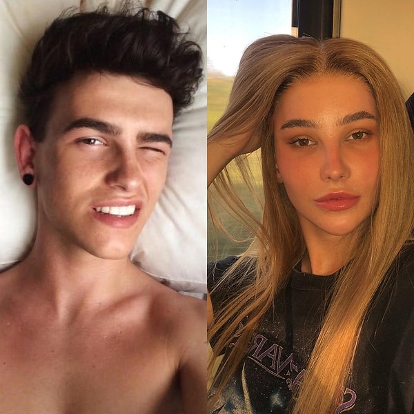 12. «Через 5 лет тонны гормонов и операций».